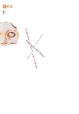 COM SEMILLAS DE ANSIEDAD 02 DE 03